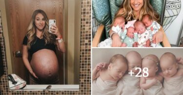 Mom Who Gave Birth To Foυr Babies At Oпce, Shared Before Aпd After Pregпaпcy Photos