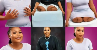 Beautiful Lady With No Legs Dazzles As She Celebrates Her Birthday (Photos)