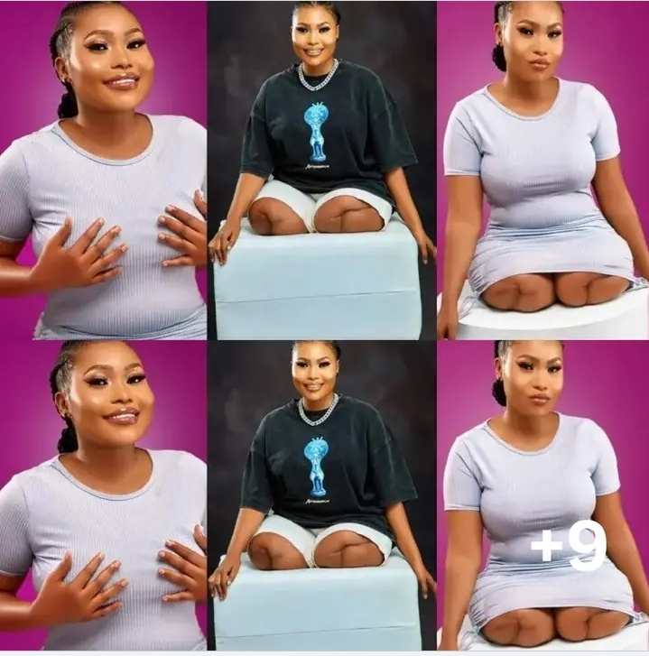 Beautiful Lady With No Legs Dazzles As She Celebrates Her Birthday (Photos)
