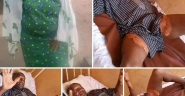 Nigerian Woman pours hot water on husband’s pen!s for planning to marry another woman (Photos) ‎
