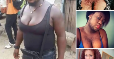 Meet The Nigerian Woman Who Have The Face Of A Man And Body Of A Woman (Photos) ‎